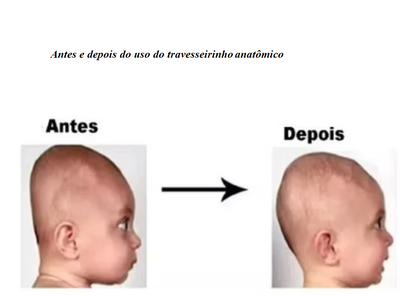 Kit 2 Peças Naninha e Travesseiro Anatómico